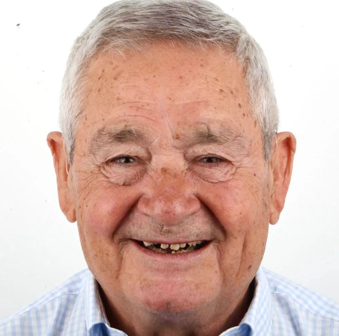 Homem a sorrir antes do tratamento, com poucos dentes, partidos e escurecidos