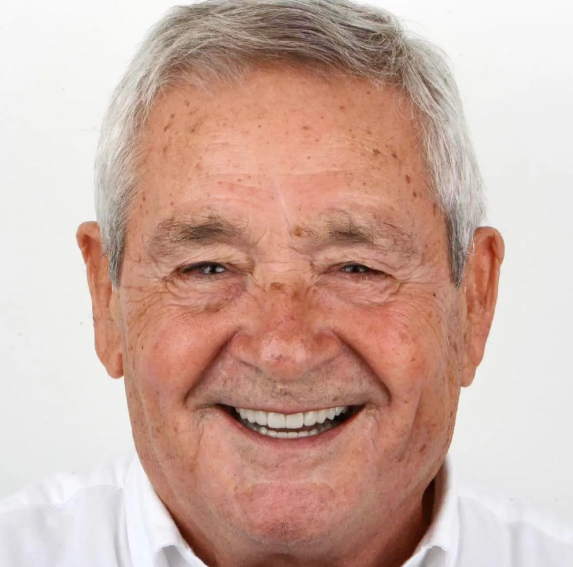 O mesmo homem depois do tratamento, com um sorriso completo e dentes brancos