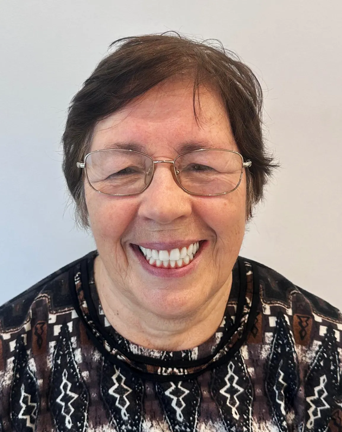 A mesma mulher depois do tratamento, com um sorriso completo e dentes brancos