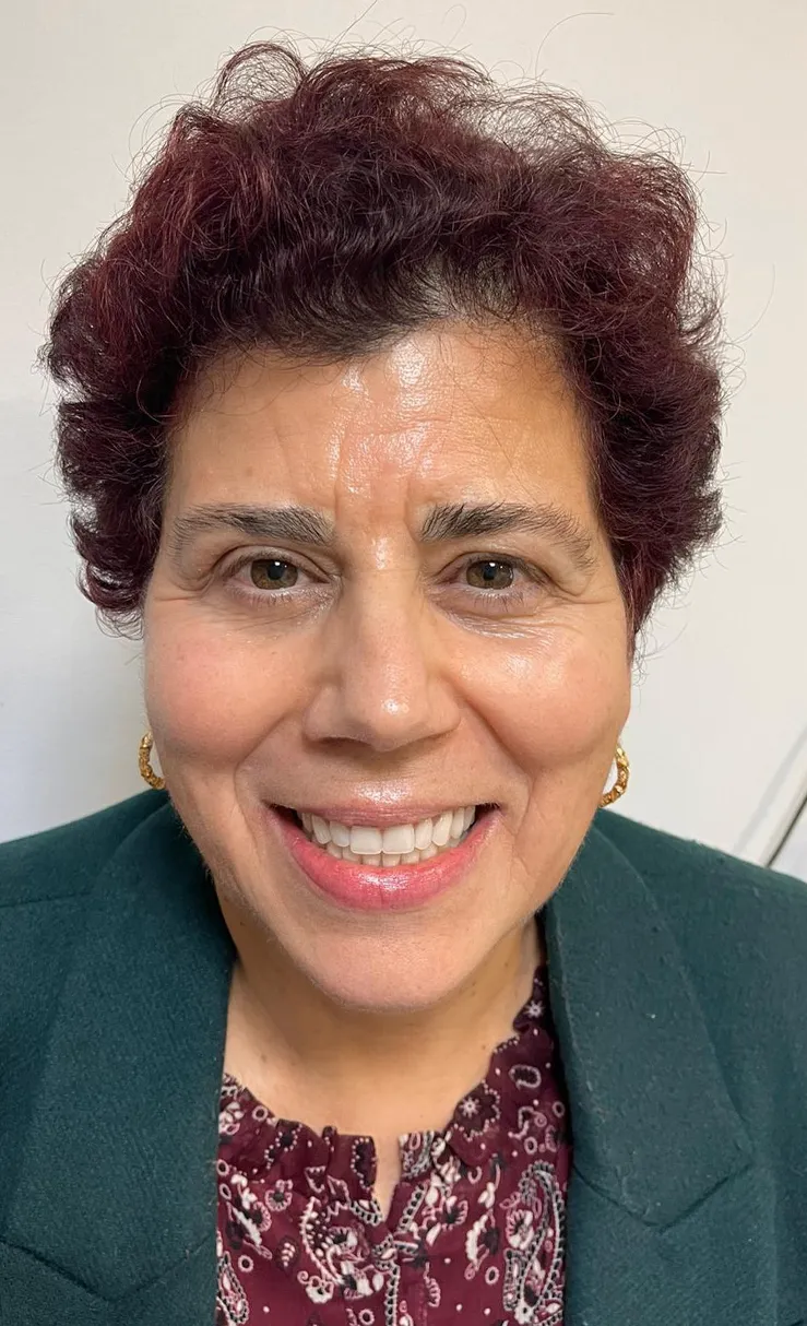 A mesma mulher depois do tratamento, com as falhas preenchidas e o sorriso completo