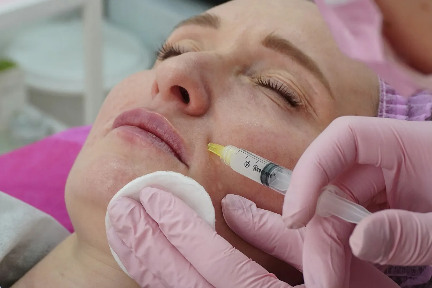 Aplicação de um procedimento de harmonização facial numa paciente, na Boca a Boca